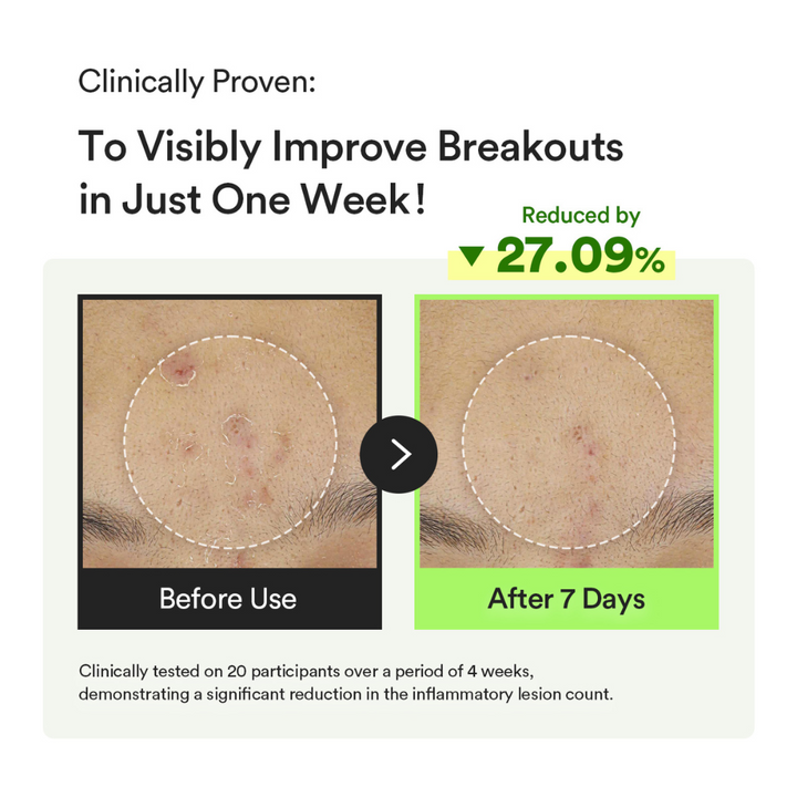 Heartleaf Teca Capsule Serum Calming Drop (50ml)