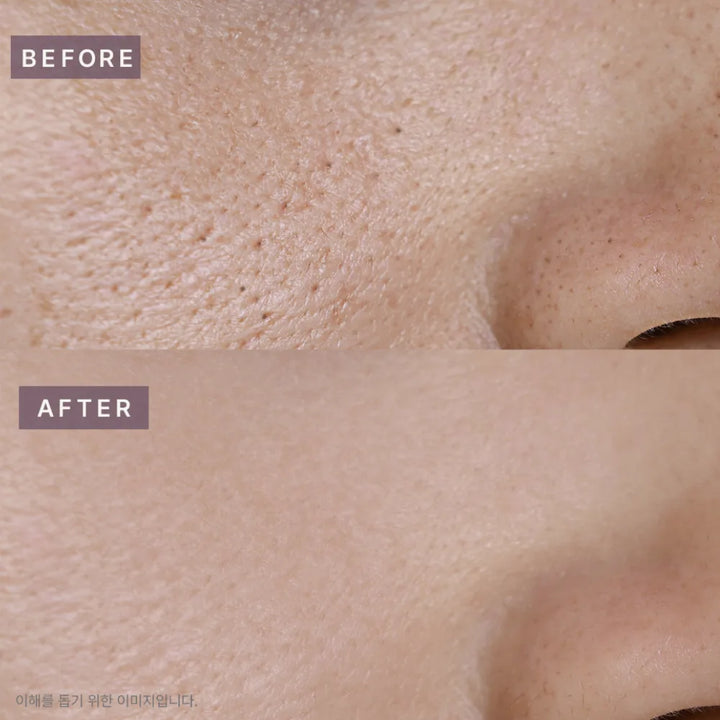 Pot Pore Tightening Podo Ampoule (52ml)