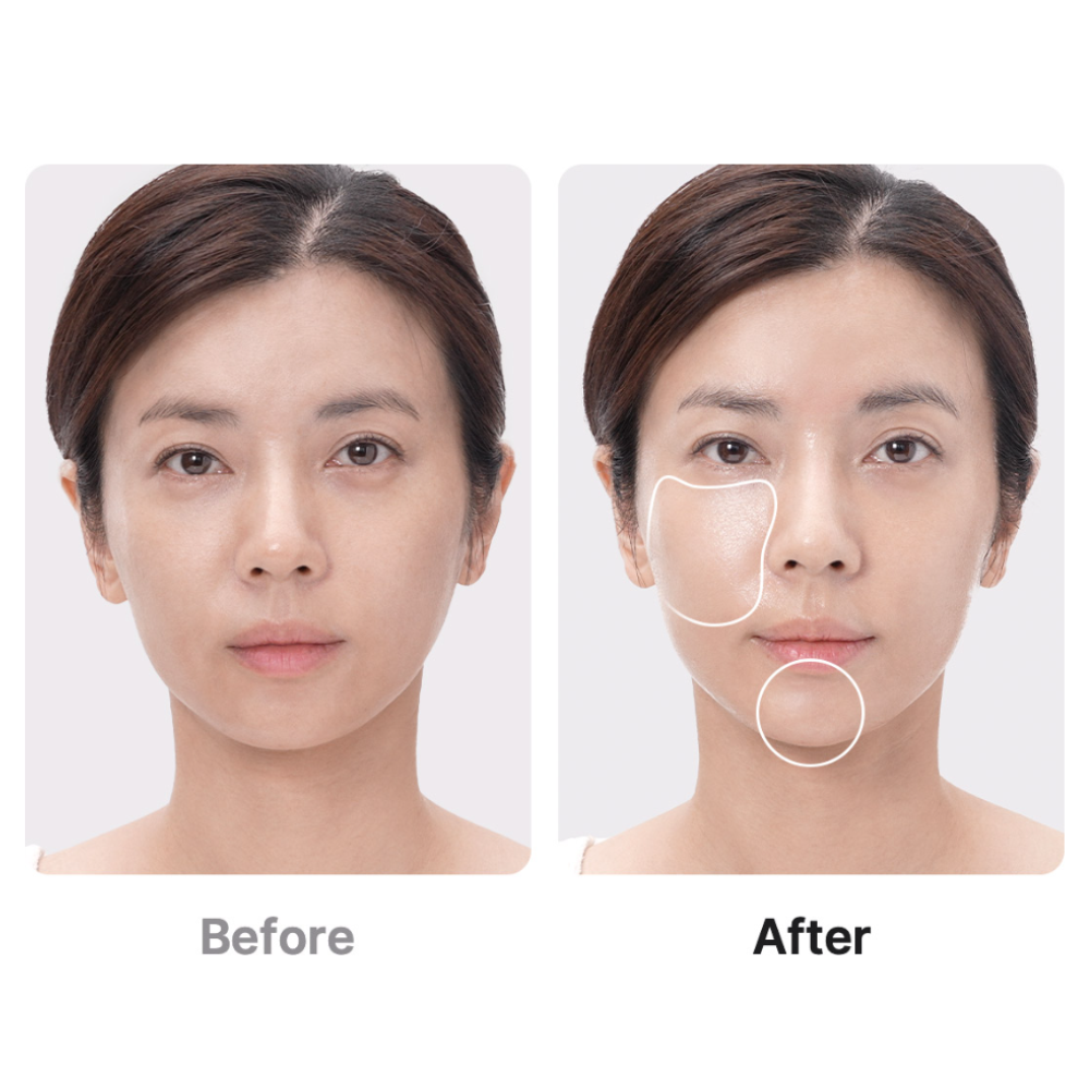 AGE-R Booster Pro (1pc)