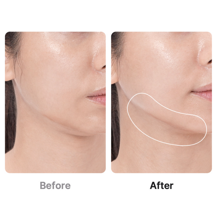 AGE-R Booster Pro (1pc)