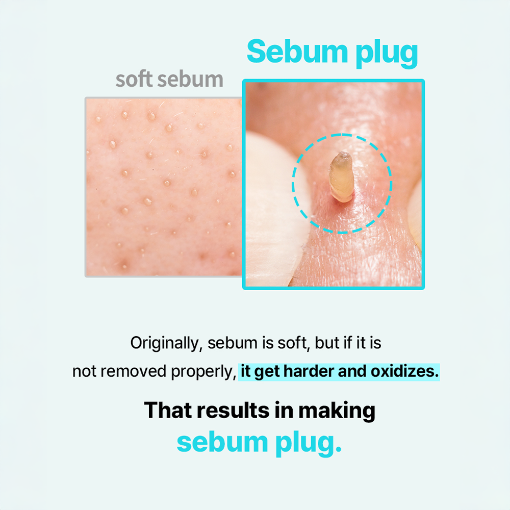 ILSO Super Melting Sebum Softener (150g) – PURESEOUL