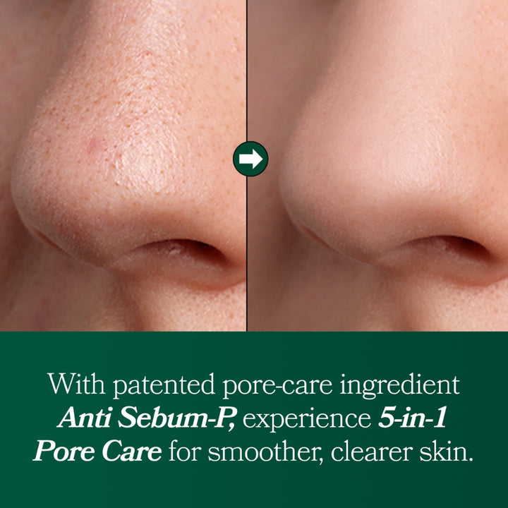 Fresh Lime Glow & Pore Refining Serum (50ml)