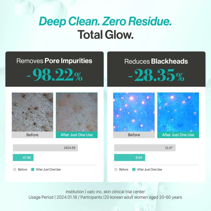 Fresh Lime Pore Clearing Daily Cleansing Oil (200ml)