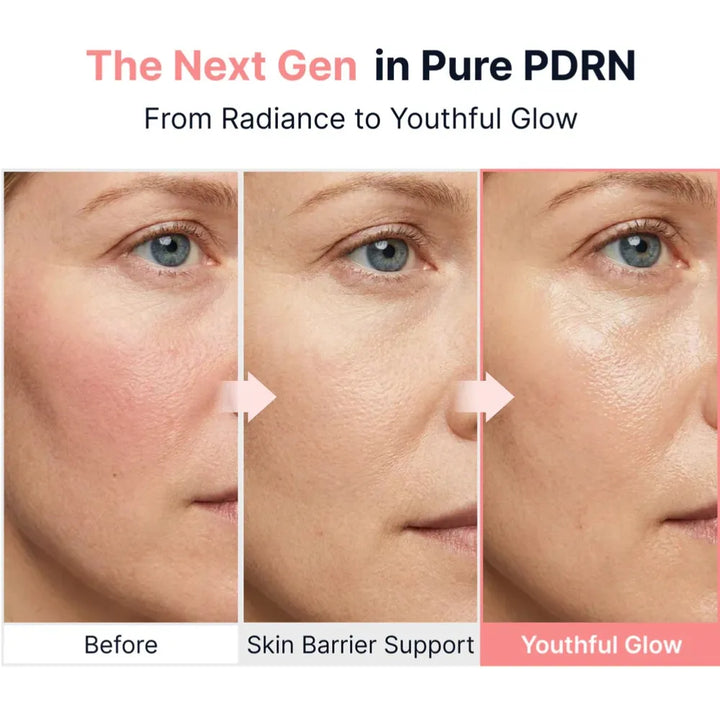 PDRN Pink Vitamin Glow Boosting Ampoule (40ml)